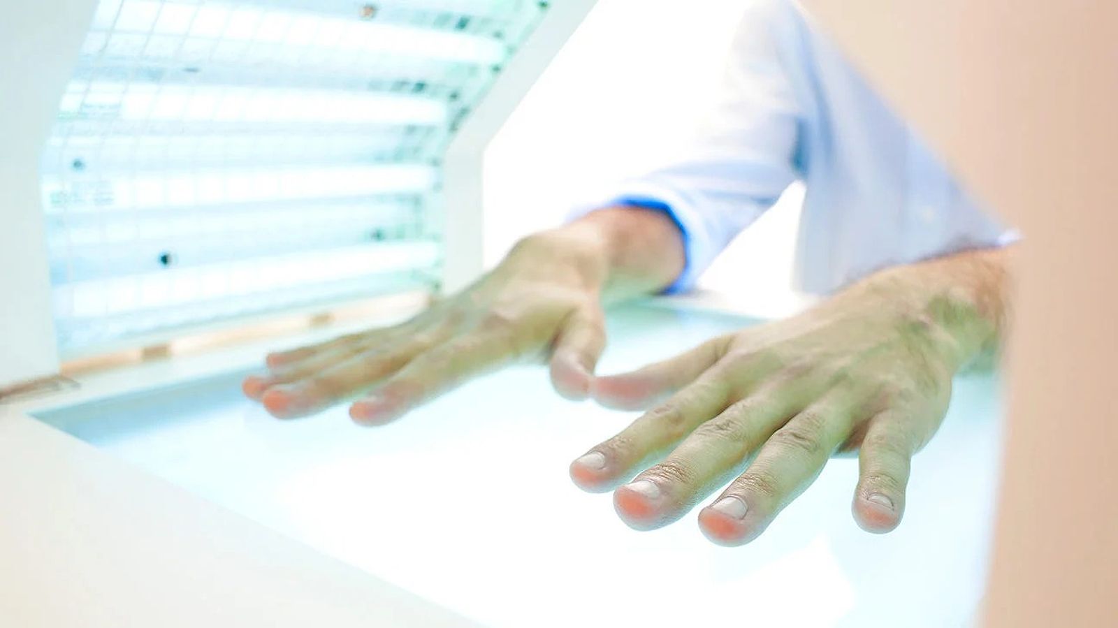 Light therapy for psoriasis