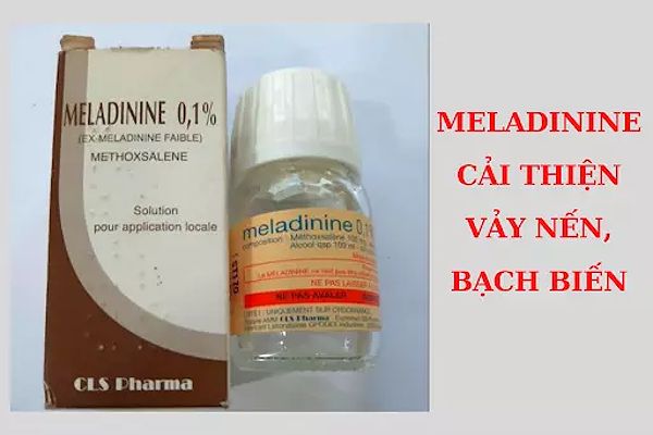 Thuoc-boi-meladinine-giup-cai-thien-vay-nen-bach-bien (1)